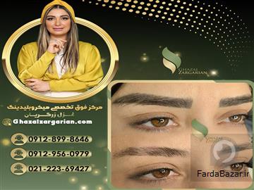 عکس آگهی مرکز ریمو ابرو در تهران با غزل زرگریان