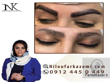 عکس آگهی قیمت ریموو تاتو در مرکز ریموو تاتو نیلوفر کاظمی