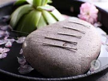 آگهی رایگان اموزش تخصصی طب سوزنی