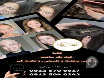 پروتز مو بانوان