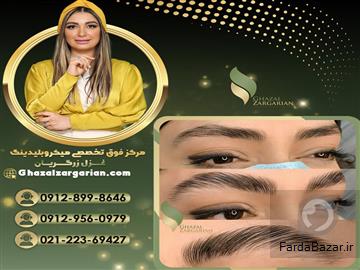 عکس آگهی قیمت لیفت و لمینت ابرو در شمال تهران