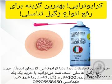 آگهی رایگان فروش اسپری کرایوتراپی نیتروکسی درمان زگیل تناسلی در خانه
